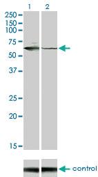 Anti-STK33 Mouse Monoclonal Antibody [clone: 6G1]