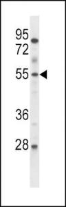 Anti-ETV6 Rabbit Polyclonal Antibody (APC (Allophycocyanin))