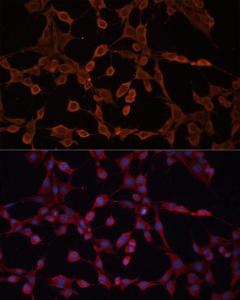 Immunofluorescence analysis of NIH-3T3 cells using Anti-ABCB11 / BSEP Antibody (A12260) at a dilution of 1:100 (40x lens). DAPI was used to stain the cell nuclei (blue).