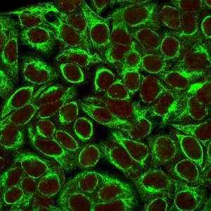 Anti-Cytokeratin 8 antibody