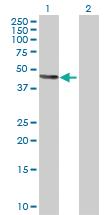 Anti-ATP4B Mouse Polyclonal Antibody