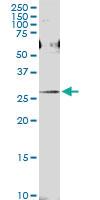 Anti-PRDX4 Polyclonal Antibody Pair