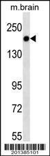 Anti-TSC1 Mouse Monoclonal Antibody [clone: 357CT4.4.2]