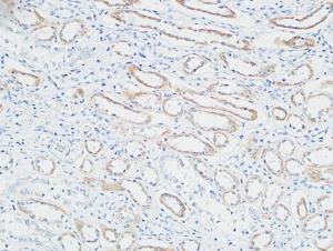 Immunohistochemical analysis of paraffin-embedded human Right kidney using Anti-PTTG Antibody