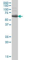 Anti-IRAK2 Mouse Monoclonal Antibody [clone: 4B6]