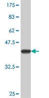 Anti-ATP6V0A2 Mouse Polyclonal Antibody