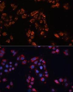 Immunofluorescence analysis of HeLa cells using Anti-ABCB11 / BSEP Antibody (A12260) at a dilution of 1:100. DAPI was used to stain the cell nuclei (blue).