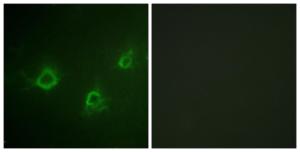 Immunofluorescence analysis of COS7 cells using Anti-PLCG1 Antibody. The right hand panel represents a negative control, where the Antibody was pre-incubated with the immunising peptide