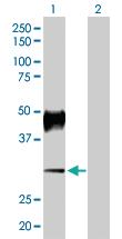 Anti-ATP4B Rabbit Polyclonal Antibody