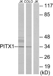 Antibody anti-PITX1 100 µg