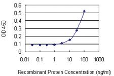 Anti-DDAH1 Mouse Monoclonal Antibody [clone: 3F7]