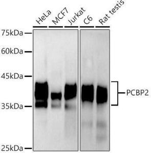 Western blot analysis of extracts of various cell lines, using Anti-PCBP2/hnRNP E2 Antibody [ARC2994] (A309620) at 1:1000 dilution. The secondary Antibody was Goat Anti-Rabbit IgG H&L Antibody (HRP) at 1:10000 dilution