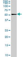 Anti-CDK8 Mouse Monoclonal Antibody [clone: 6E5]