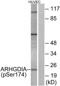 Western blot analysis of lysates from HUVEC cells treated with EGF 200ng/ml 30' using Anti-ARHGDIA (phospho Ser174) Antibody. The right hand lane represents a negative control, where the antibody is blocked by the immunising peptide.