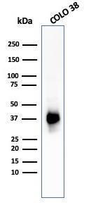 Western blot analysis of COLO-38 cell lysate using Anti-Melanoma gp100 Antibody [PMEL/783]