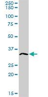 Anti-ATP4B Rabbit Polyclonal Antibody