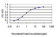 Anti-IRAK2 Mouse Monoclonal Antibody [clone: 4B6]