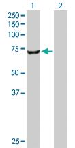 Anti-CROT Rabbit Polyclonal Antibody