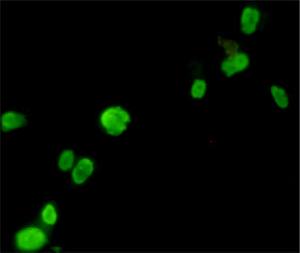 Anti-FOXP3 Mouse Monoclonal Antibody [clone: 13k55]