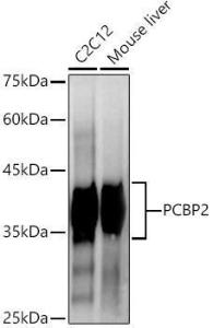 Western blot analysis of extracts of various cell lines, using Anti-PCBP2/hnRNP E2 Antibody [ARC2994] (A309620) at 1:1000 dilution. The secondary Antibody was Goat Anti-Rabbit IgG H&L Antibody (HRP) at 1:10000 dilution