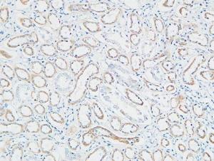 Immunohistochemical analysis of paraffin-embedded human Right kidney using Anti-PTTG Antibody