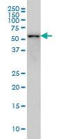 Anti-CDK8 Mouse Monoclonal Antibody [clone: 6E5]