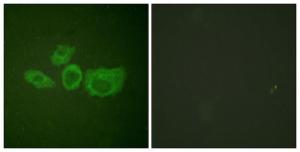 Immunofluorescence analysis of HUVEC cells using Anti-Tyrosine Hydroxylase Antibody. The right hand panel represents a negative control, where the antibody was pre-incubated with the immunising peptide