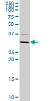 Anti-ATP4B Rabbit Polyclonal Antibody