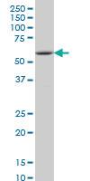 Anti-IRAK2 Mouse Monoclonal Antibody [clone: 4C11]