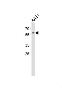 Anti-PAX3 Rabbit Polyclonal Antibody (HRP (Horseradish Peroxidase))