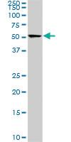 Anti-CDK8 Mouse Monoclonal Antibody [clone: 6E5]