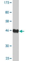 Anti-AGR2 Mouse Monoclonal Antibody [clone: 1E5]