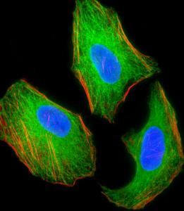 Anti-TSC2 Mouse Monoclonal Antibody (APC (Allophycocyanin)) [clone: 249CT19.1.3]