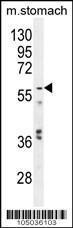 Anti-GPC3 Rabbit Polyclonal Antibody (AP (Alkaline Phosphatase))