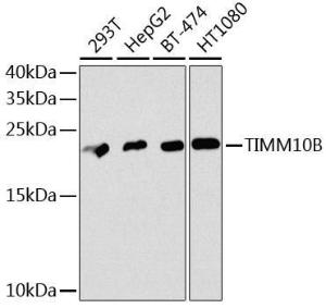 Western blot analysis of extracts of various cell lines, using Anti-TIMM10B Antibody (A12264) at 1:1,000 dilution. The secondary antibody was Goat Anti-Rabbit IgG H&L Antibody (HRP) at 1:10,000 dilution.