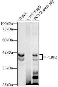 Immunoprecipitation analysis of 300 µg extracts of HeLa cells using 3 µg of Anti-PCBP2/hnRNP E2 Antibody [ARC2994] (A309620). This Western blot was performed on the immunoprecipitate using Anti-PCBP2/hnRNP E2 Antibody [ARC2994] (A309620) at a dilution of1:1000