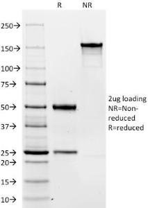 SDS-PAGE analysis of Anti-CD19 Antibody [C19/366] under non-reduced and reduced conditions; showing intact IgG and intact heavy and light chains, respectively. SDS-PAGE analysis confirms the integrity and purity of the antibody.