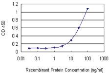 Anti-STK33 Mouse Monoclonal Antibody [clone: 6G1]