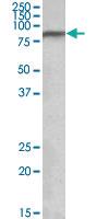 Anti-NDUFS1 Goat Polyclonal Antibody