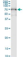 Anti-GALNT6 Polyclonal Antibody Pair