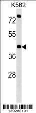 Anti-P2RX2 Rabbit Polyclonal Antibody (FITC (Fluorescein Isothiocyanate))