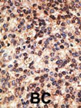 Anti-Jagged2 Rabbit Polyclonal Antibody (PE (Phycoerythrin))