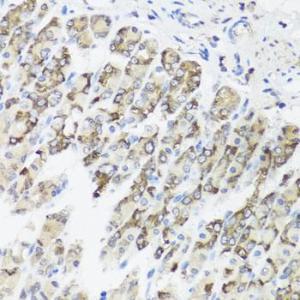 Immunohistochemistry analysis of paraffin-embedded mouse stomach using Anti-TIMM10B Antibody (A12264) at a dilution of 1:100 (40x lens)