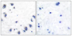 Immunohistochemical analysis of paraffin-embedded human brain tissue using Anti-Tyrosine Hydroxylase Antibody. The right hand panel represents a negative control, where the antibody was pre-incubated with the immunising peptide