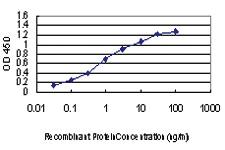 Anti-IRAK2 Mouse Monoclonal Antibody [clone: 4C11]