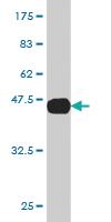 Anti-AGR2 Mouse Monoclonal Antibody [clone: 1C3]