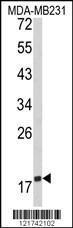 Anti-CD28 Rabbit Polyclonal Antibody (APC (Allophycocyanin))