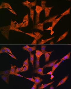 Immunofluorescence analysis of NIH-3T3 cells using Anti-USP10 Antibody [ARC1015] (A306928) at a dilution of 1:100 (40X lens). DAPI was used to stain the cell nuclei (blue)