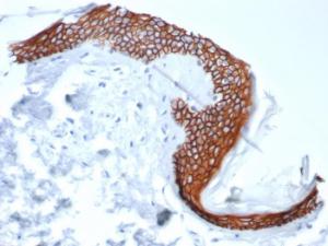 Immunohistochemical analysis of formalin-fixed, paraffin-embedded human tonsil tissue using Anti-Syndecan 1 Antibody [SDC1/7180]