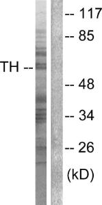 Western blot analysis of lysates from NIH/3T3 cells, treated with Forskolin 40nM 30' using Anti-Tyrosine Hydroxylase Antibody. The right hand lane represents a negative control, where the antibody is blocked by the immunising peptide